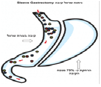 %d7%a9%d7%a8%d7%95%d7%95%d7%9c